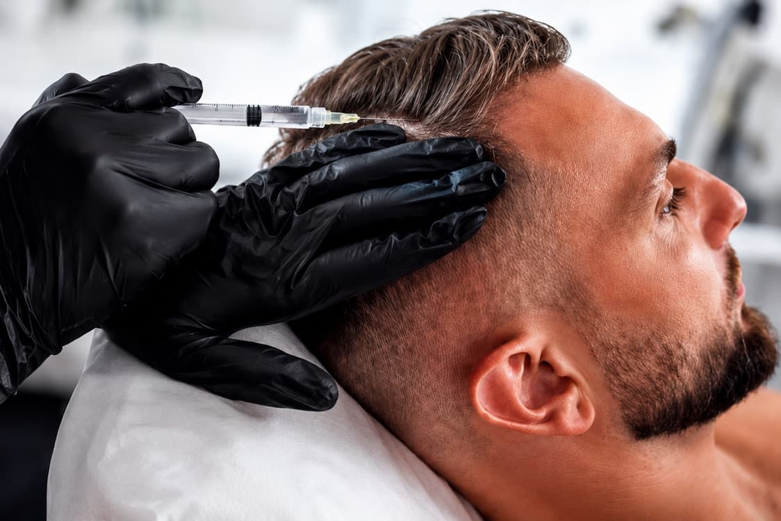 Hair Restoration